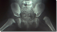 radiografia articulației șoldului