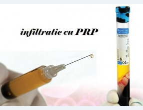 Infiltratii cu acid hialuronic in genunchi | ascorcraiova.ro