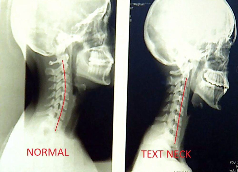 Afectiuni ale coloanei vertebrale